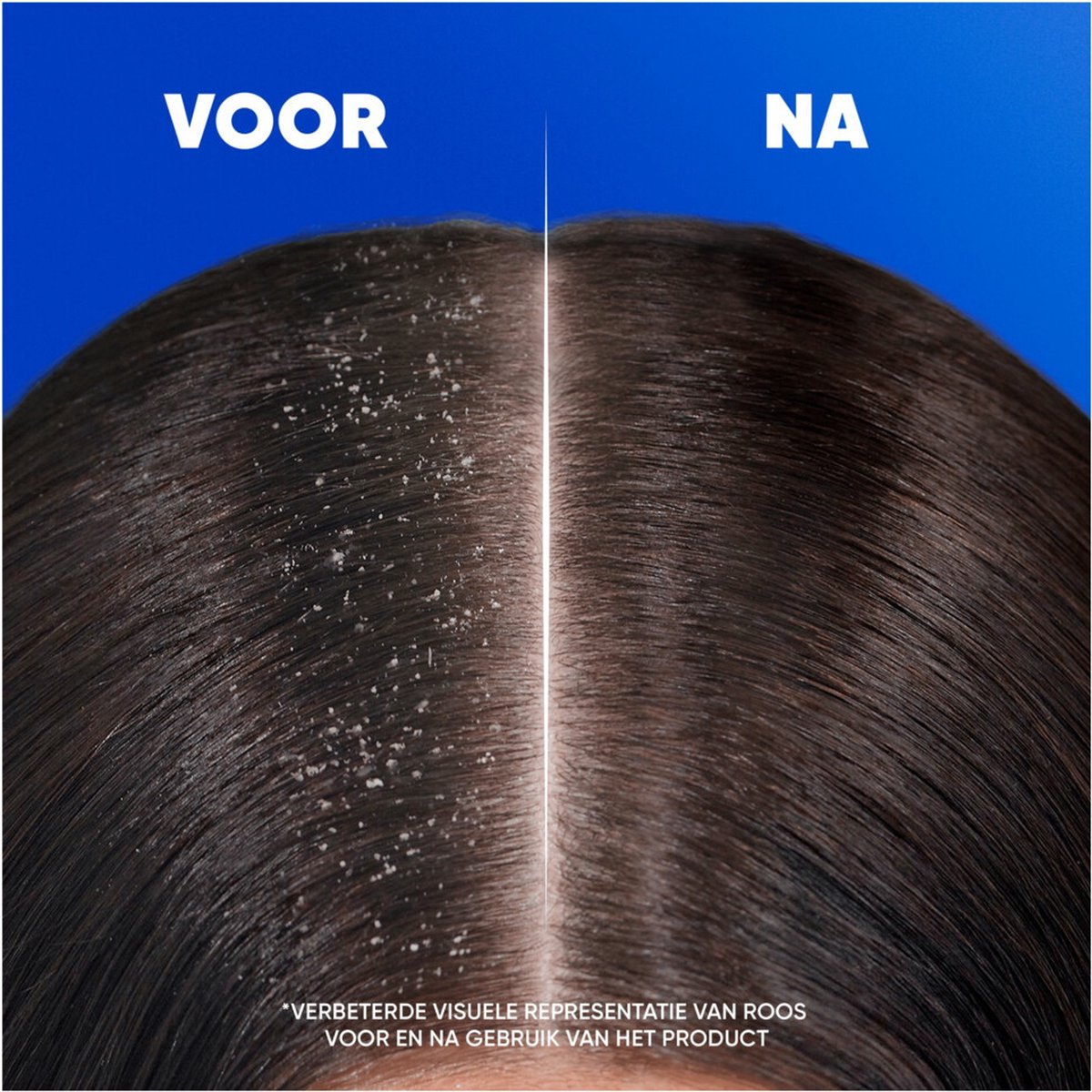 Head & Shoulders Shampoo 400 ml	Citrus Fresh