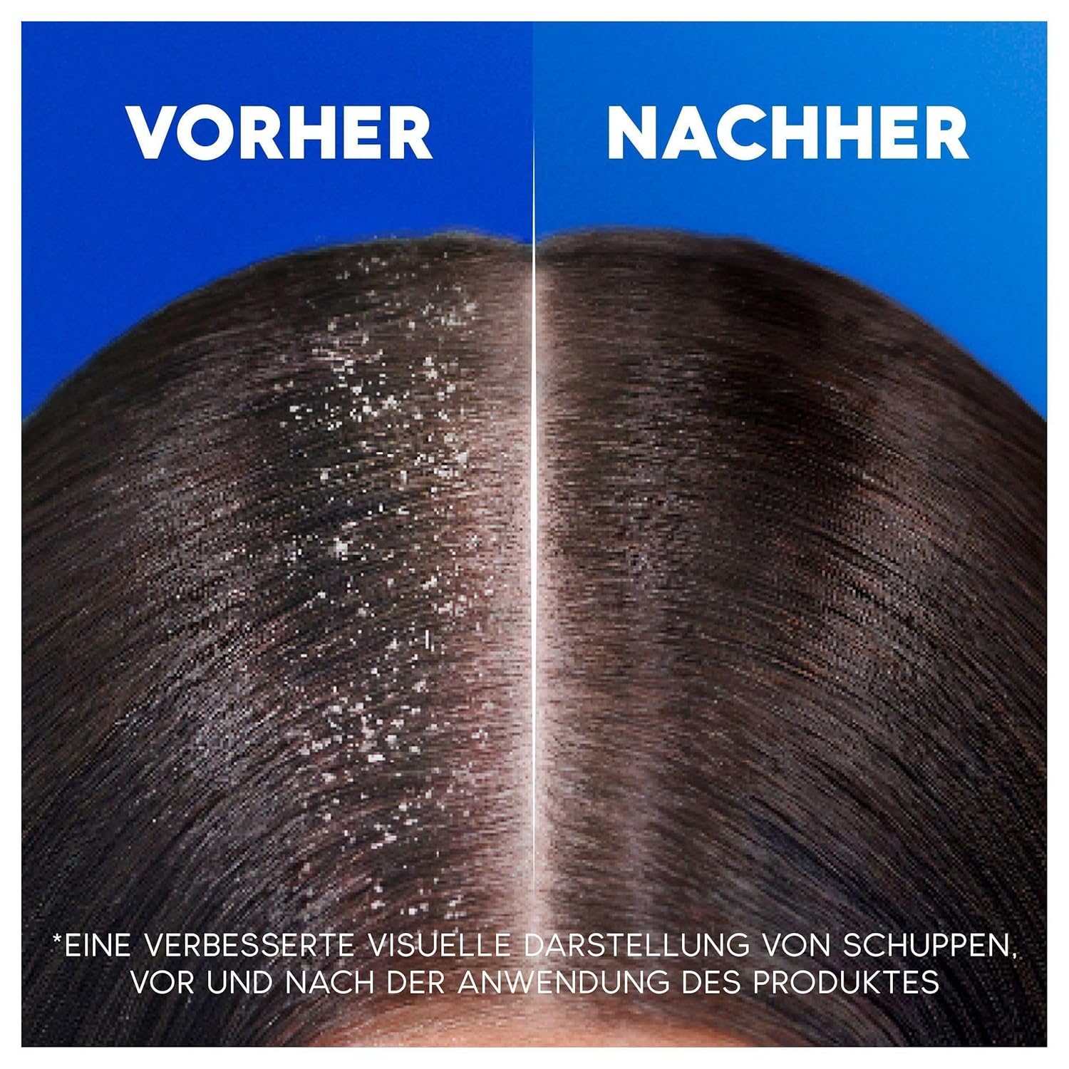 Head & Shoulders Shampoo 400 ml	Itchy Scalp